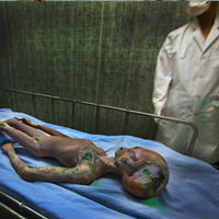 Alien Autopsy - Roswell New Mexico  509th Bomber Squadron/ Base medical staff